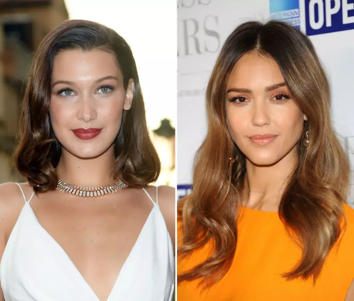 An Overview of the Endoscopic Facelift Procedure